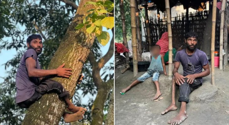 এক পা অচল, তবুও গাছের মগডালে উঠে সংসার চালান একরামুল